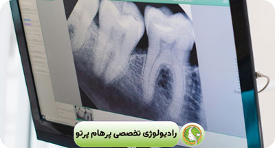 اهمیت و مزایای رادیوگرافی فک و صورت در دندانپزشکی عمومی و تخصصی